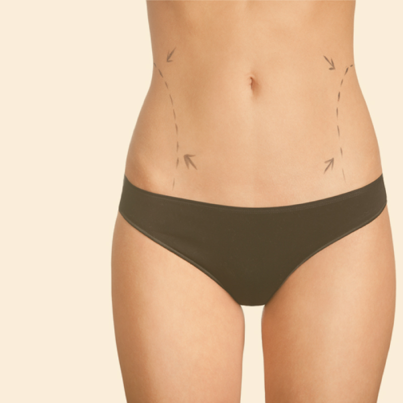 Pensando em fazer uma lipoaspiração? Conheça os benefícios e os riscos da cirurgia